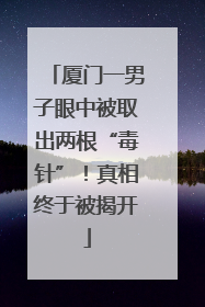 厦门一男子眼中被取出两根“毒针”！真相终于被揭开